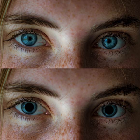 dilated pupils