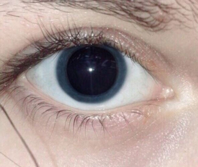 heavy amphetamine use effects