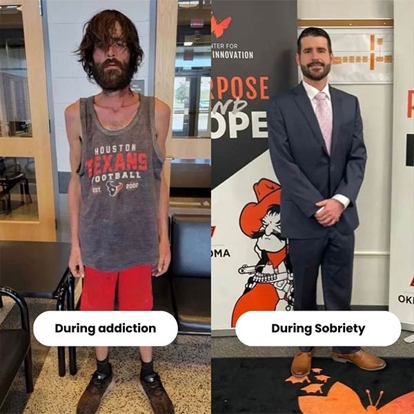 Still Detox alumnus during methamphetamine addiction and after recovery