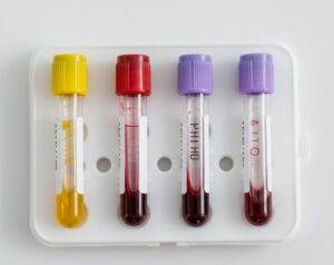 how long does alcohol stay in your system