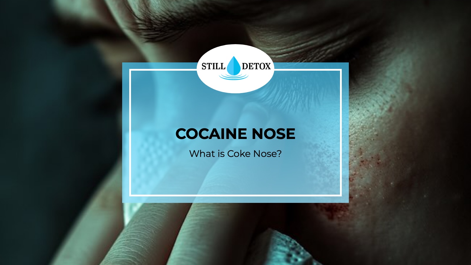 Cocaine Nose: What is Coke Nose? title card from Still Detox