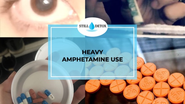 Heavy Amphetamine Use