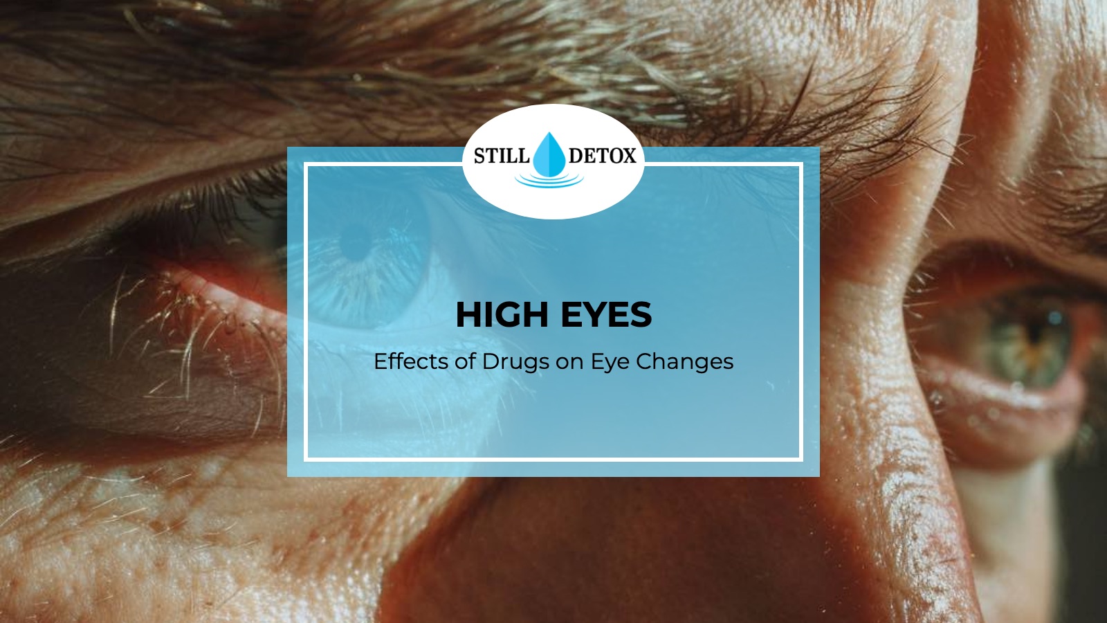 High Eyes: Effects of Drugs on Eye Changes title card from Still Detox